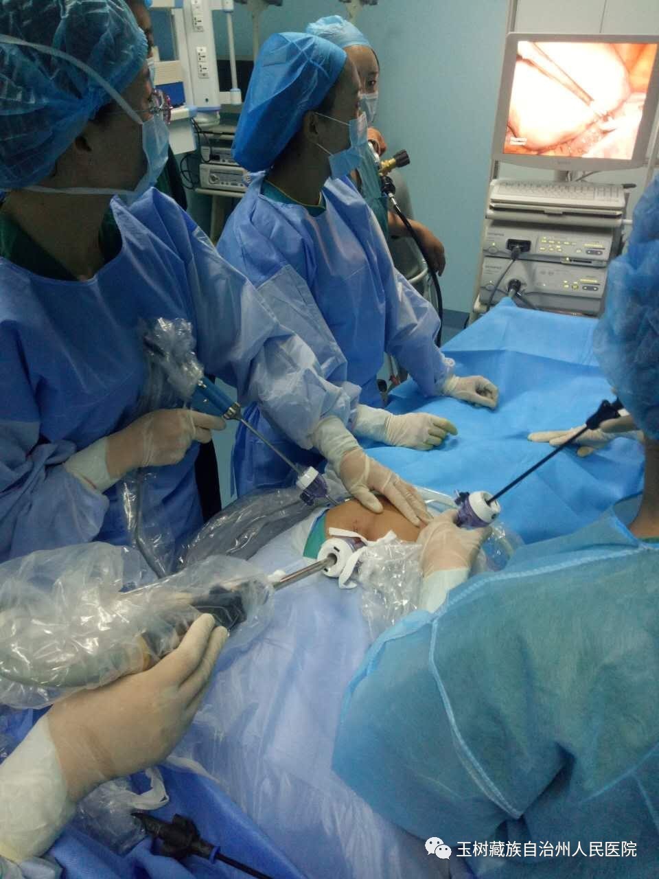 玉树州人民医院妇产科开展腹腔镜手术,填补医院技术空白